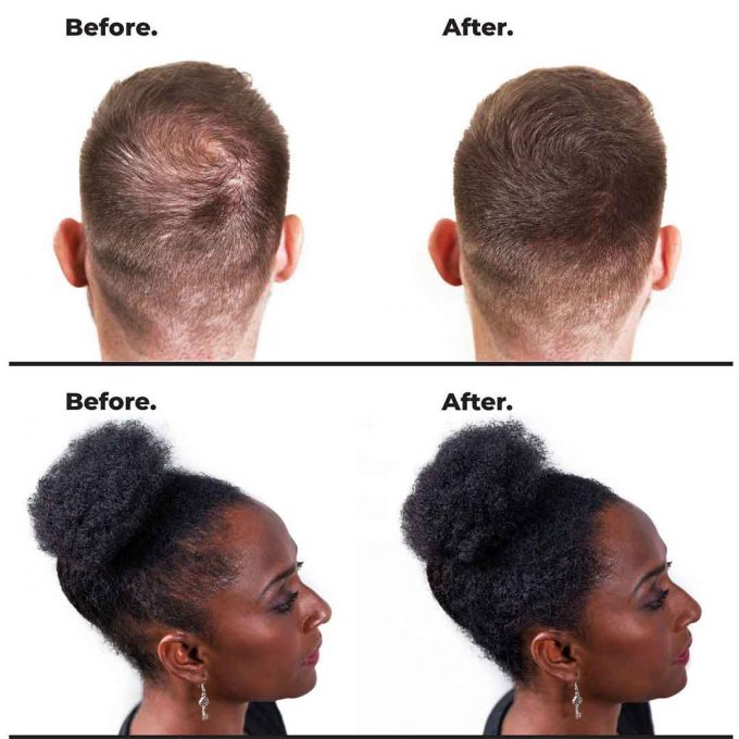 Nanogen-Before-After-haarvezels